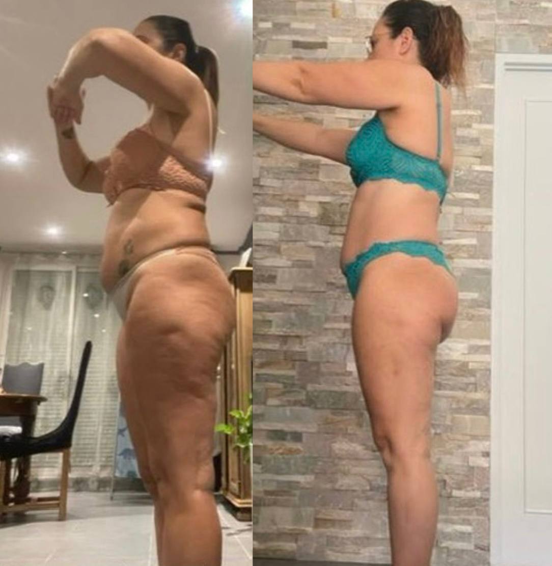 Transformation de Cristina — -5 kg et anti-cellulite