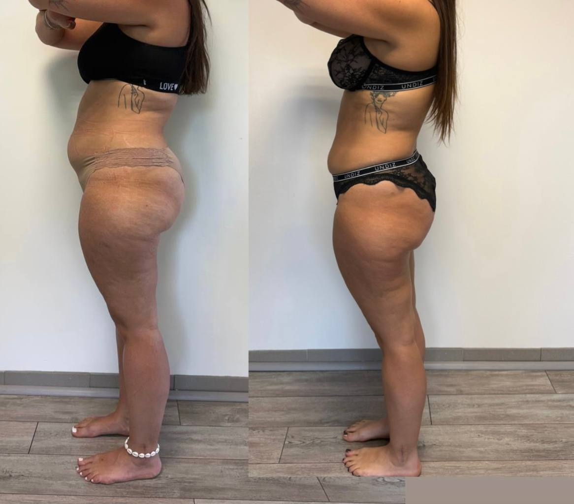 Transformation de Marine — -10 kg