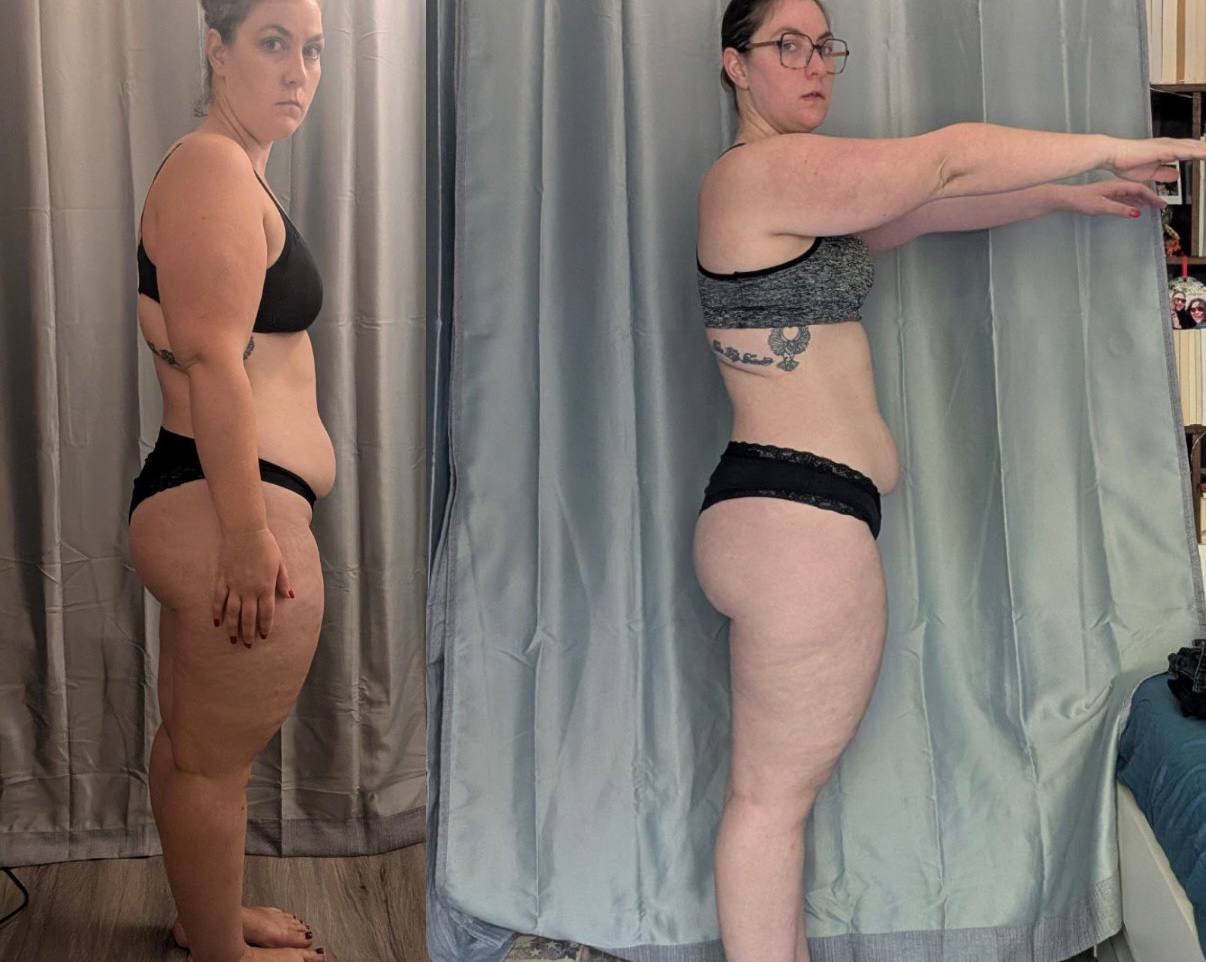 Transformation de Mélinda — -10 kg, fin de la boulimie, amélioration endométriose